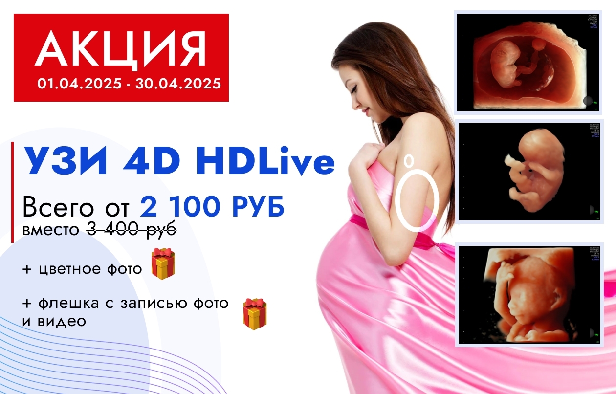 УЗИ беременности до 10 нед - 2100 руб. + подарок, с 11 нед - 2900 руб.+ подарок!